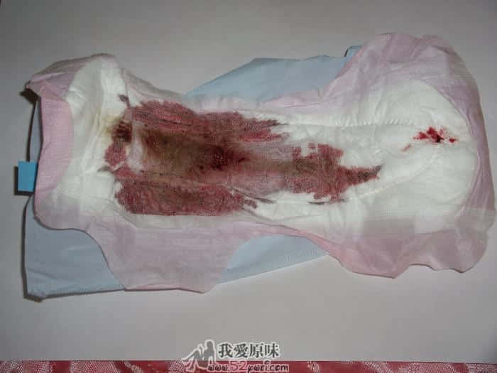 这一片味道最重！熏得我差点没吐了！不过也最刺激！上面还有子宫内膜碎片，真想吃!