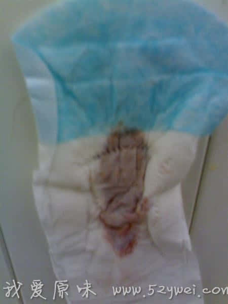 上面还有毛毛了！！！