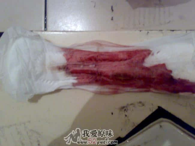 单拍。
