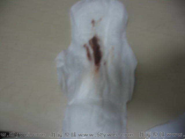 卫生巾上的经血不多