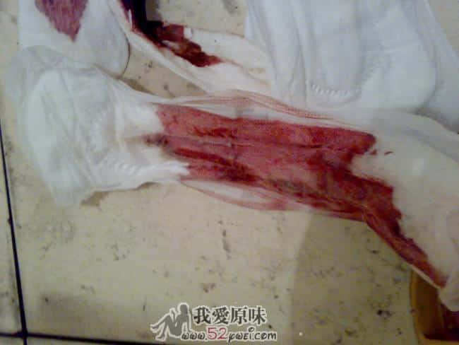 直拍。